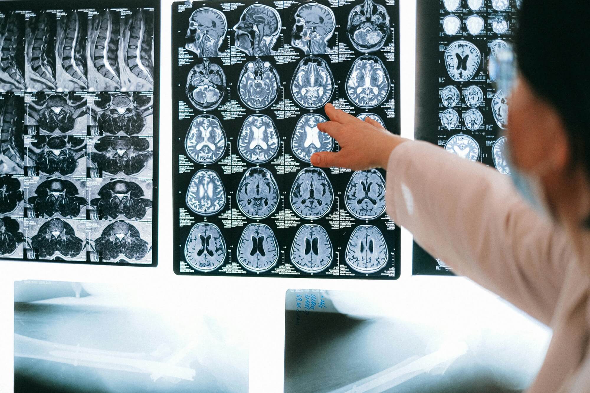 A person pointing at a screen of x-rays